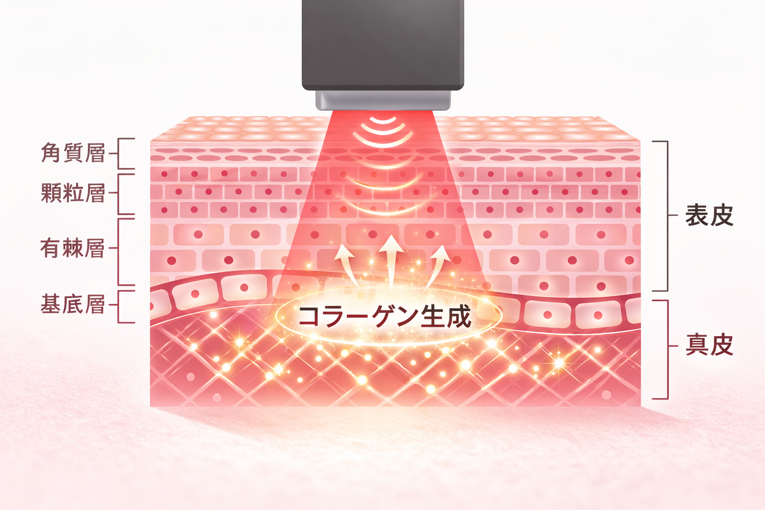 オンダリフトの仕組み - 超音波が皮膚の深層に到達しコラーゲン生成を促進